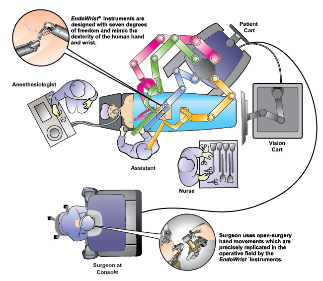 Robotic Surgery